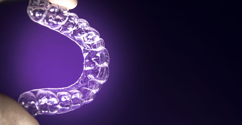 Learning about Reseda Invisalign Aligners Learning about Reseda Invisalign Aligners